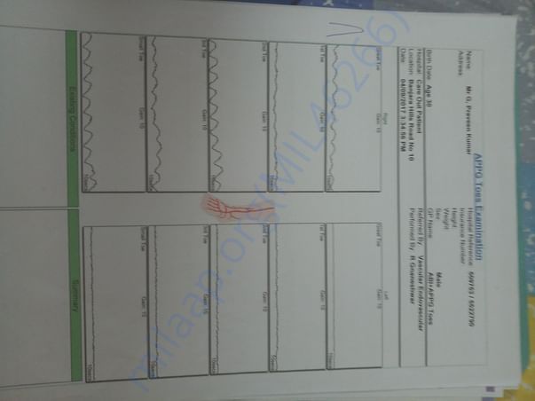 Blood Circulation Report - left leg (0%) & Right leg (20%)