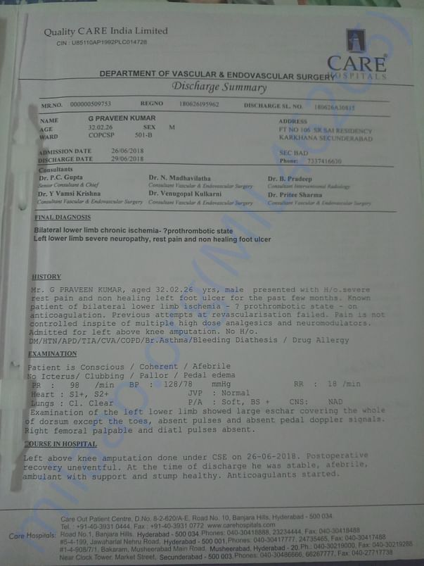 Left Leg Amputation - Discharge Summary