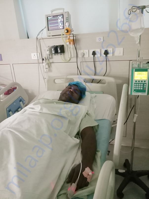 Thrombolysis Surgery - Care Hospital, Banjara Hills