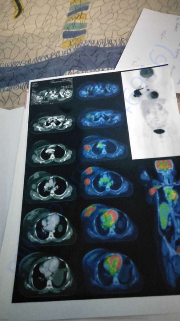 Report scan