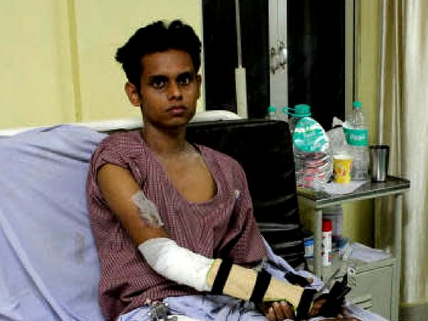 Aged Father Struggles To Save 21-Year-Old Who Already Lost His Leg
