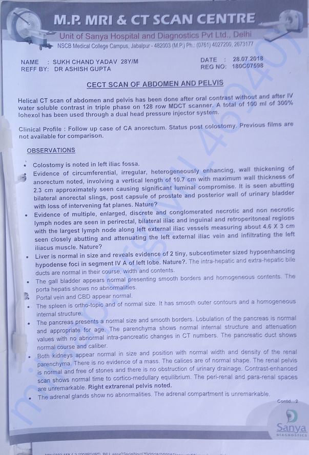 CECT Scan of Abdomen and Pelvis Report 1
