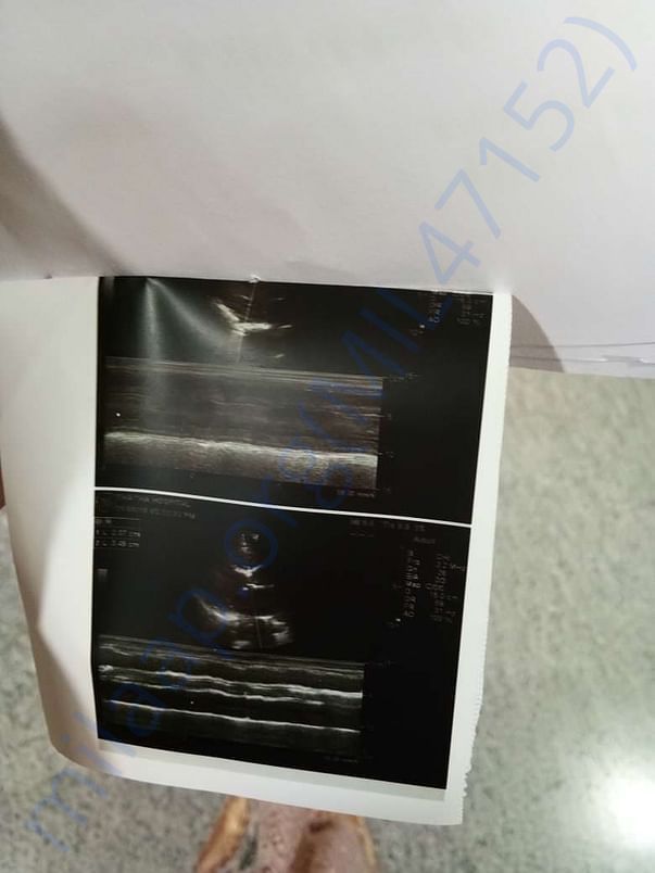 scanning