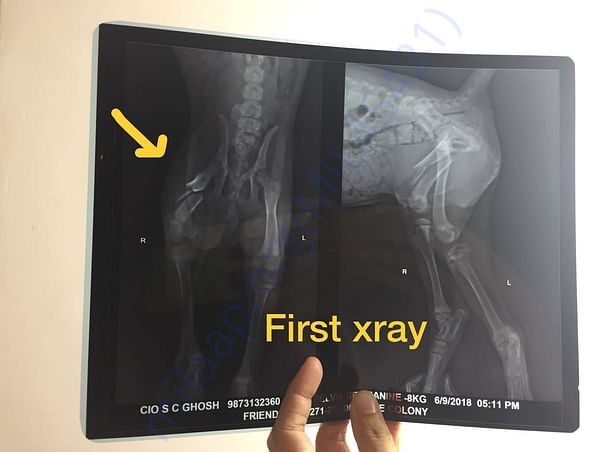 The first xray