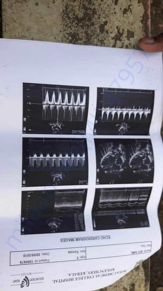 Maria Jobi medical details