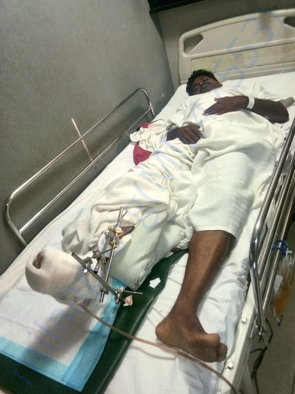During Treatment