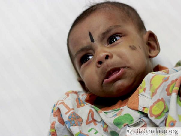 Helpless Parents Are Struggling To Save Baby Girl From Heart Disease