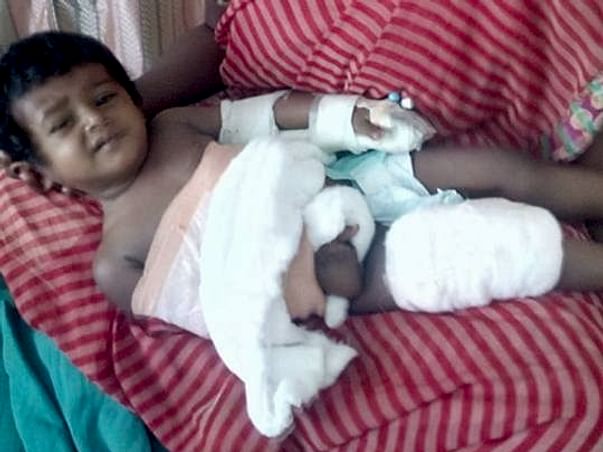 Help Mathulika To Get Her Right Hand