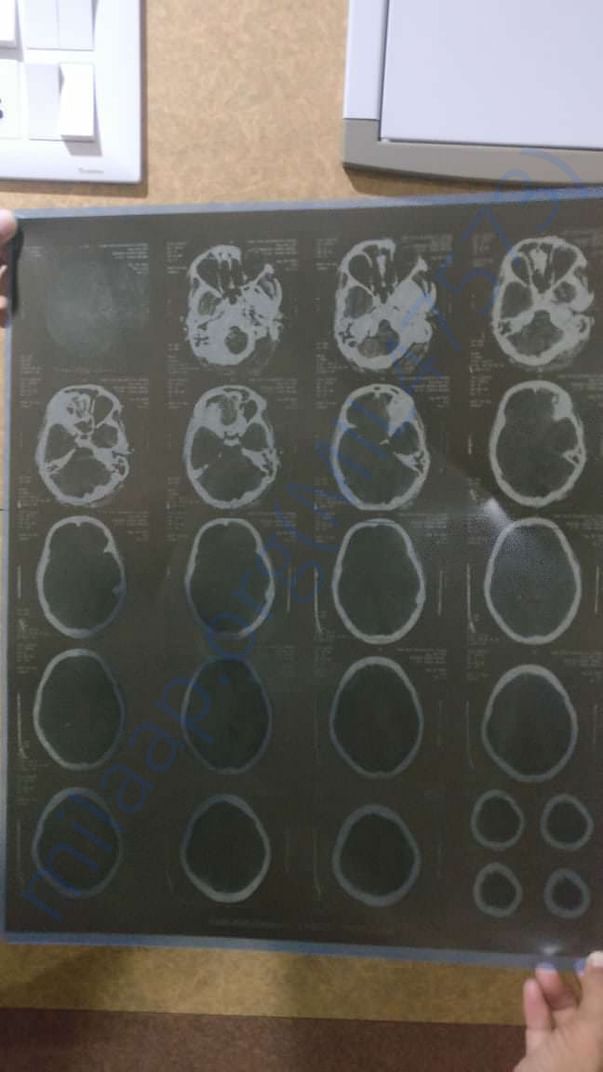 Brain MRI Scan