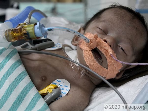 Labourer Will Lose Baby Girl To Multiple Organ Failure Without Help