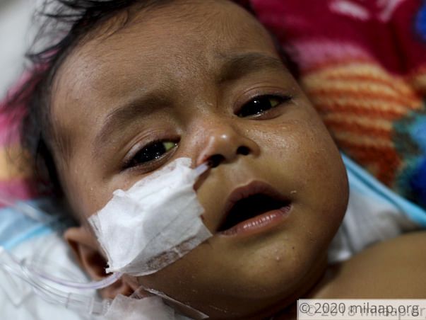 5-Month-Old With Liver Disease Has Few Days Left To Get Transplant