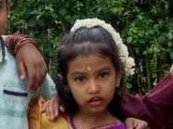 Rithvika Child Treatment for Serious Dog Bite Injury