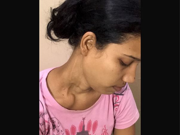 Help Rajni Recover from Carcinoma Thyroid