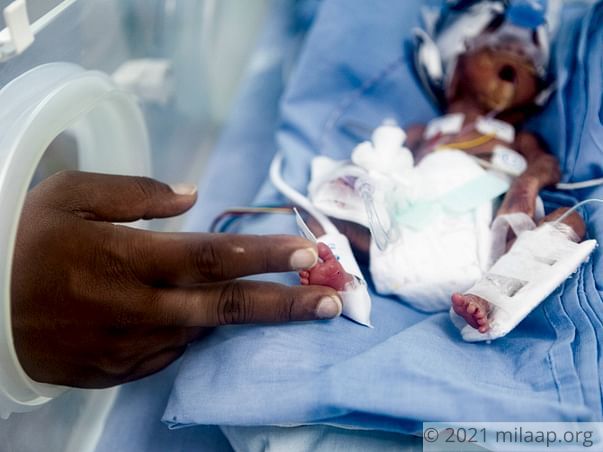 Pharmacist Needs Urgent Help To Save His Premature Baby