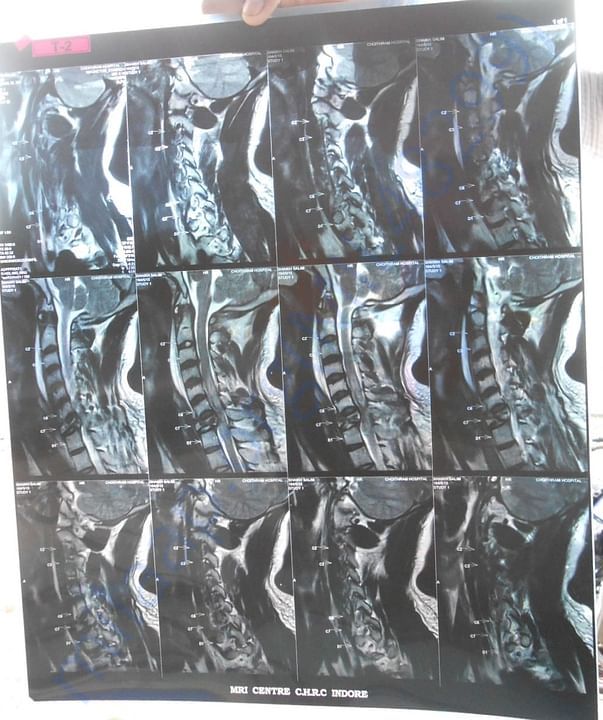 MRI