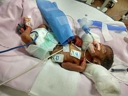 Please Save The Twin Babies