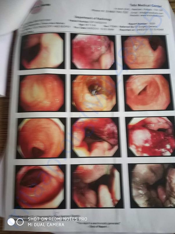 Colonoscopy