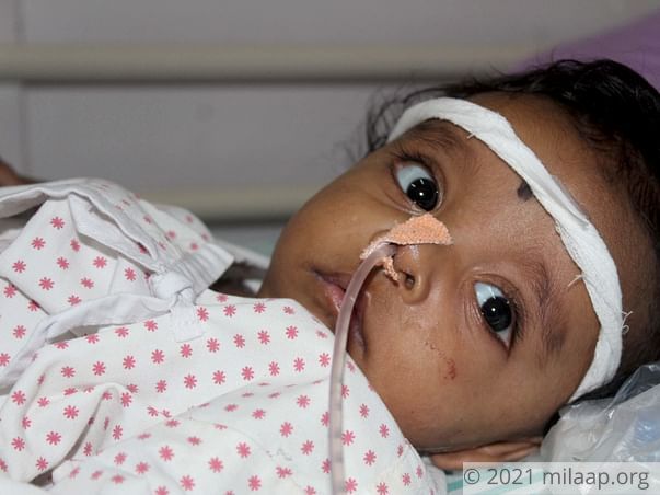 5-Month-Old Chokes Every Time He Cries Because Of Cancerous Tumour