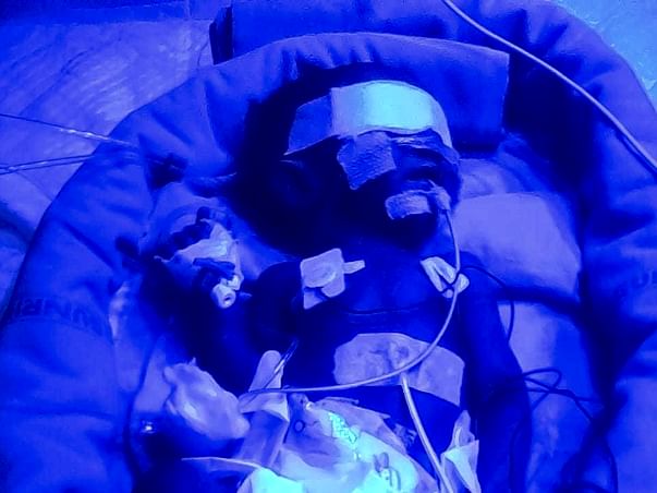 Help A Baby Undergo A Lung Surgery