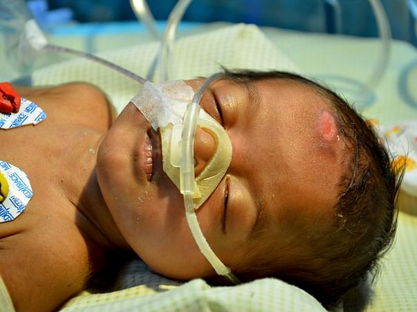3-Month-Old Baby Girl Suffering From Rare Lung Disease Needs Help
