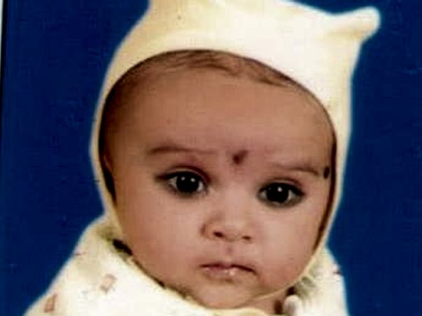 Help Baby Yashvi Undergo A Heart Operation