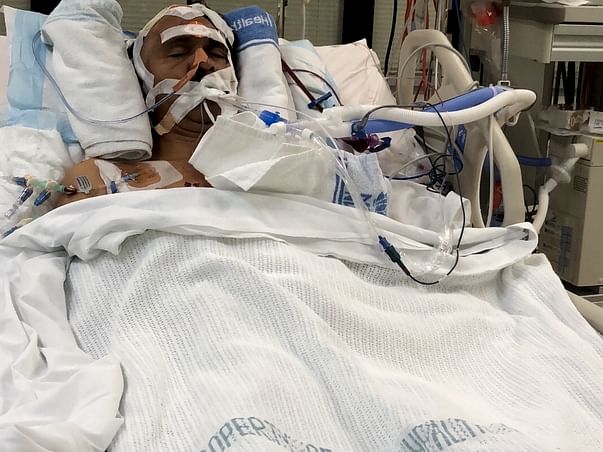 Help for my father's Brain Stroke