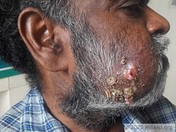 15year old son-Pleading to save his father from cancer