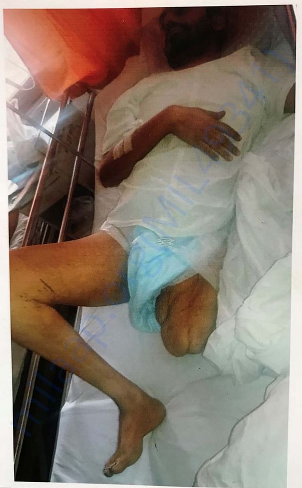 Bilal has only leg, that is also paralysed