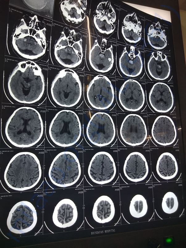 CT Scan