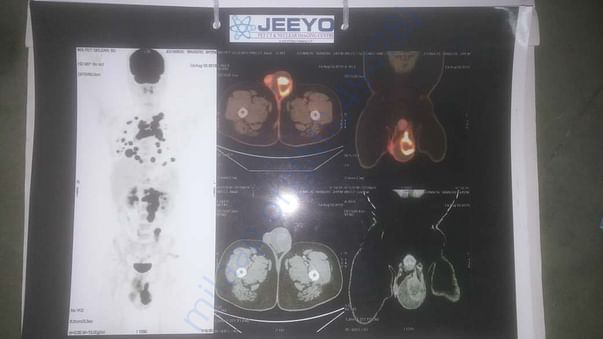Medical scans