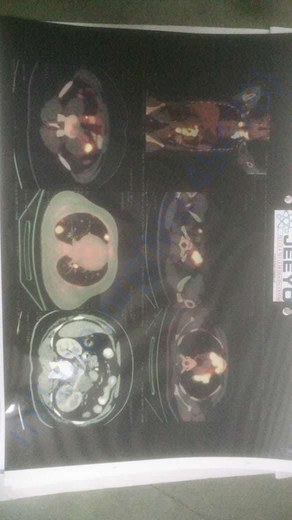 medical scan