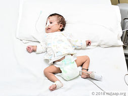 Baby Born With Serious A Heart Defect Needs Help For An Urgent Surgery
