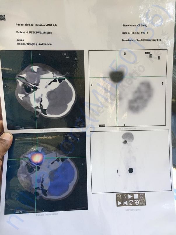 X-rays