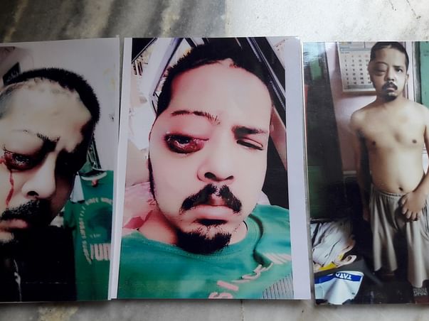 Help Mayank Fight Brain Tumor