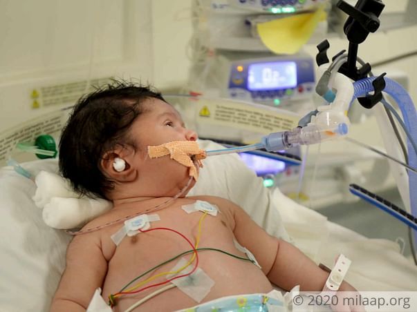 Orphanage Teacher Struggles To Save 10-Day-Old Who Cannot Eat