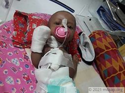 4-months old Baby of Nancy needs your support to undergo his treatment