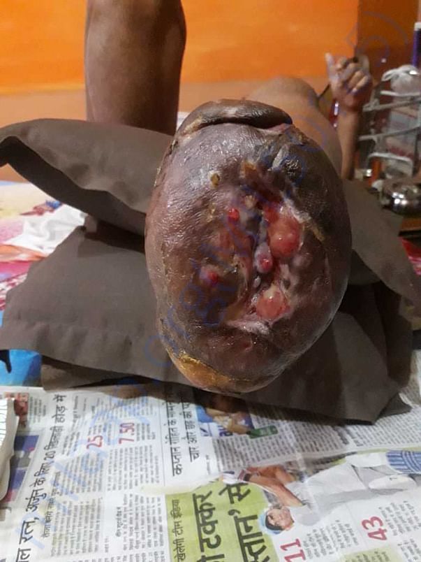 Foot image