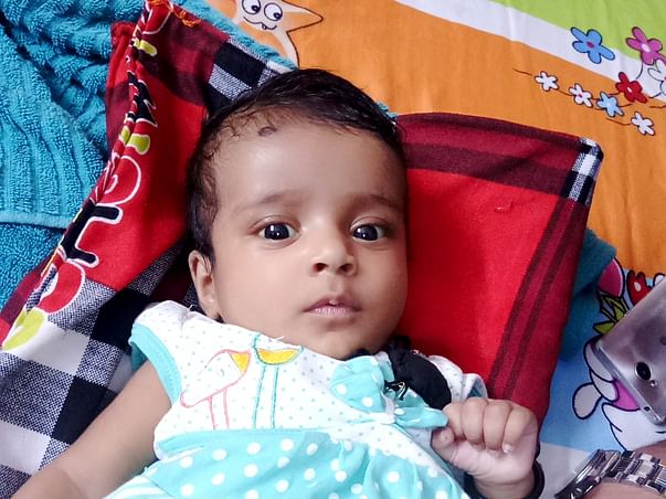 Help 3 Month Old Baby Undergo Liver Transplant
