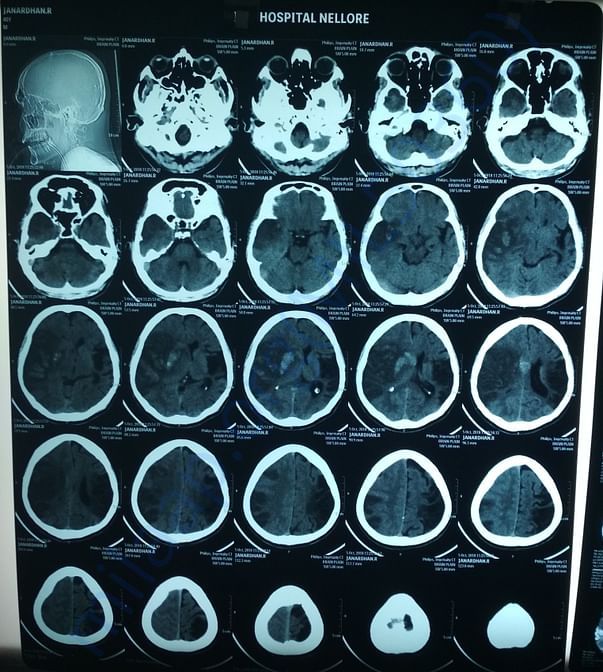 Scanning