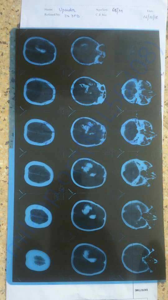 Scan report