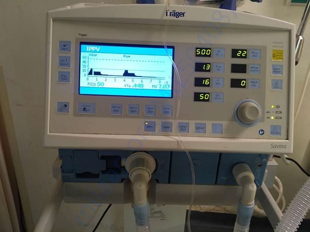 Intubation given and ventilator support