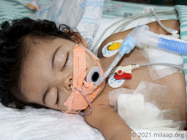 Baby Girl Who Can't Eat Or Breathe Needs Urgent Help To Live