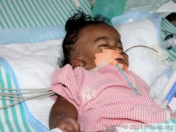 9-months old baby of Suma needs your help for his treatment