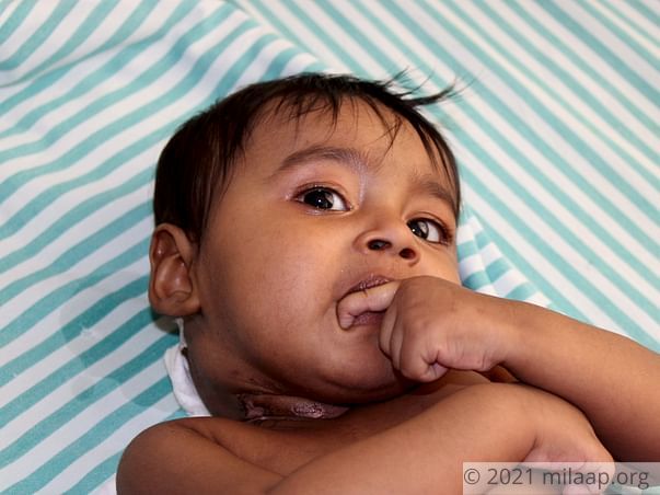 8-months old baby Lihan needs your help for the treatment