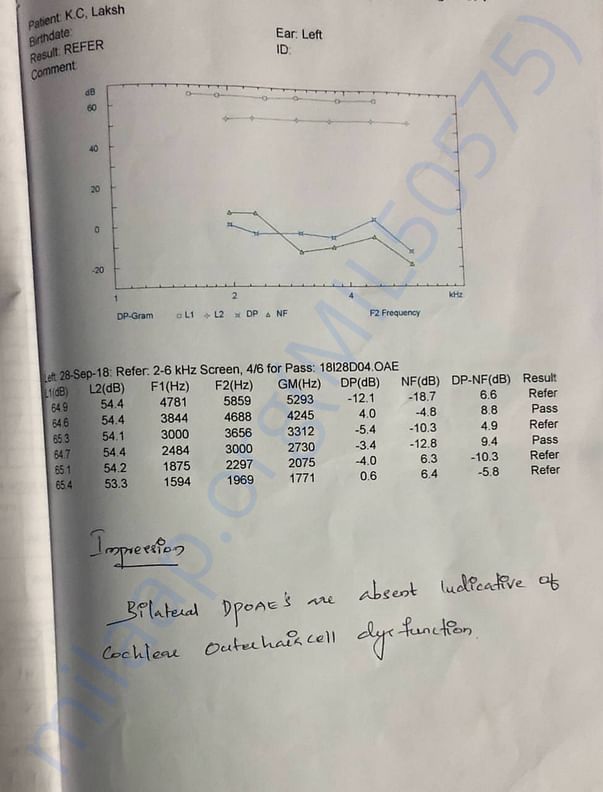 BERA and OAE hearing test result