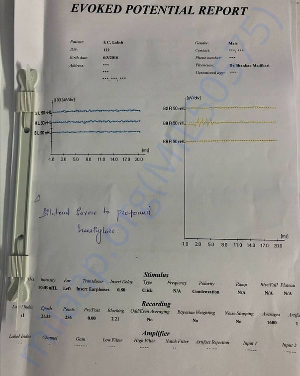 BERA and OAE test results