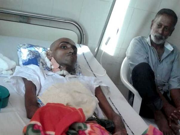 Help Ashok Undergo Throat Surgery