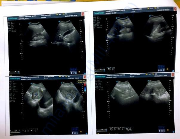 ultrasound 2