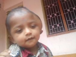 Please help 1-year-old Aromal For His Head Surgery