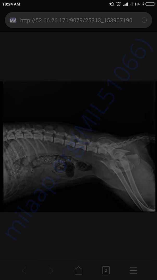 Xray